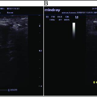 inconclusive biopsy what next.